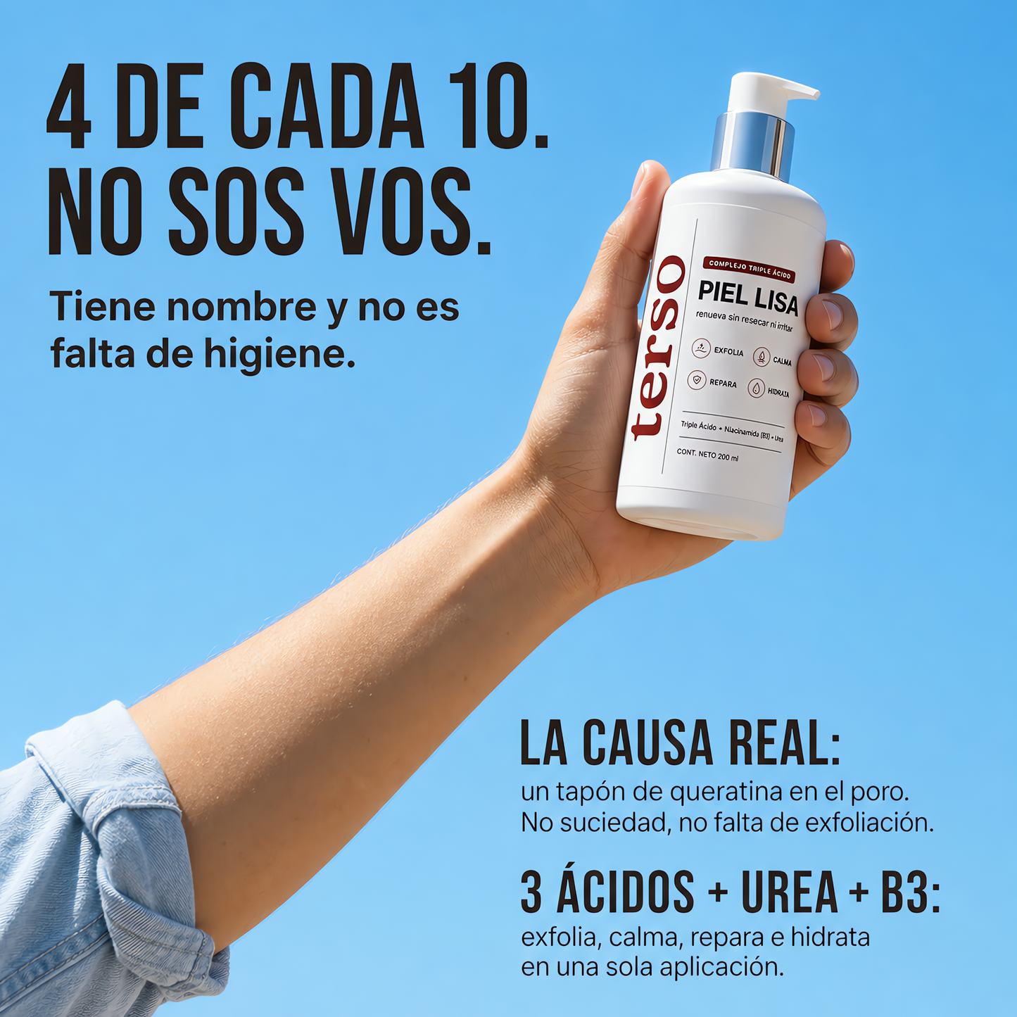 TERSO | Crema contra la queratosis pilaris y piel de gallina