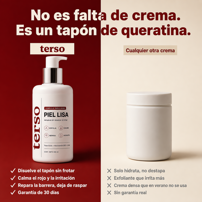 TERSO | Crema contra la queratosis pilaris y piel de gallina